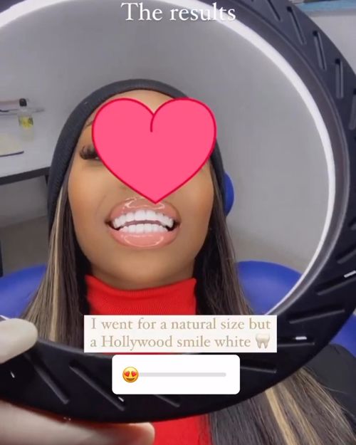 Model Teeth
