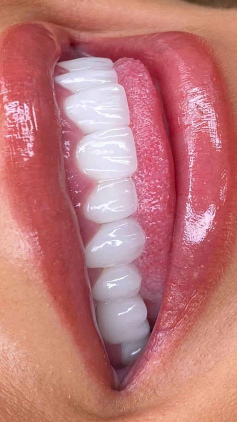 Model Teeth