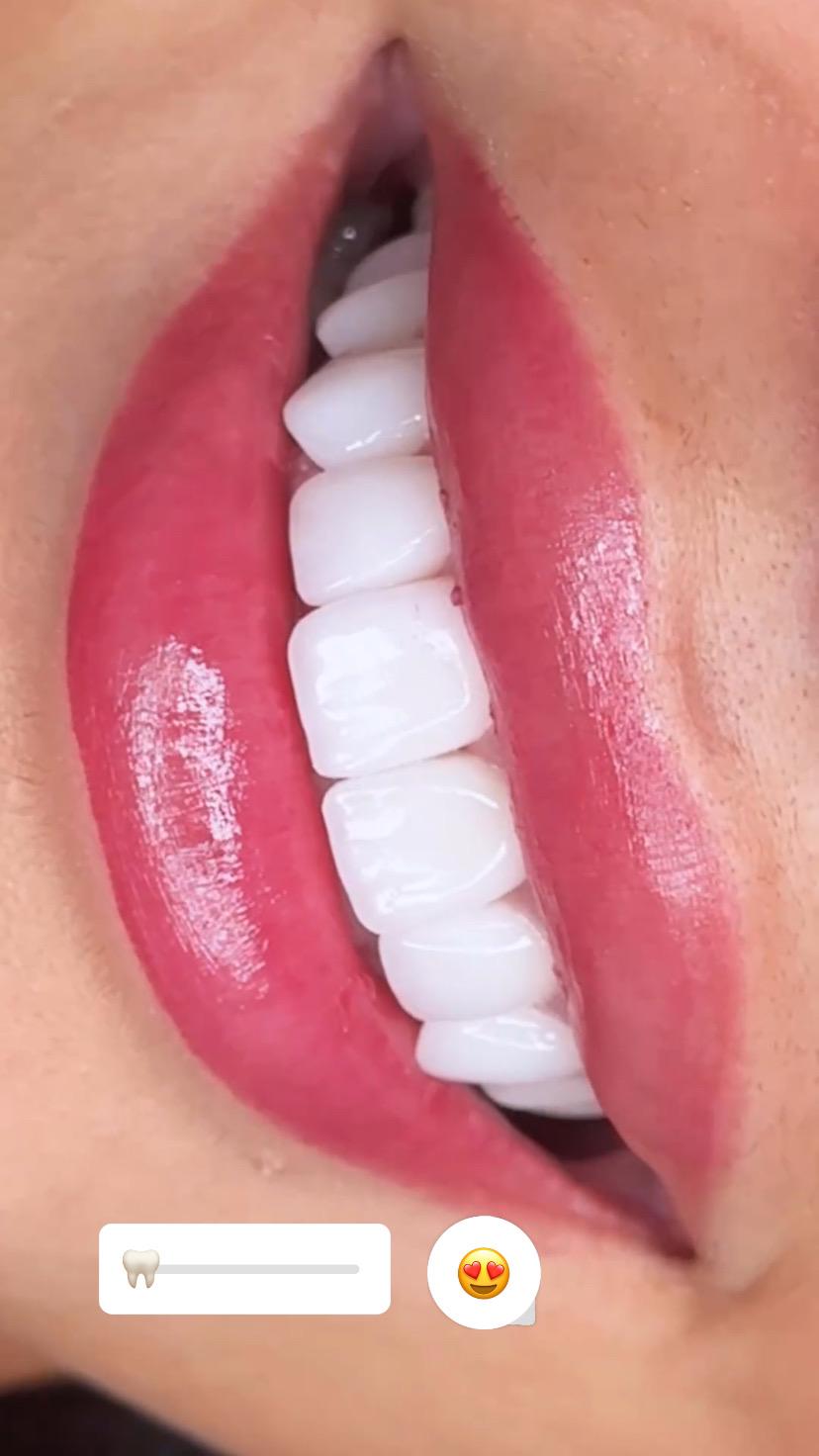 Model Teeth