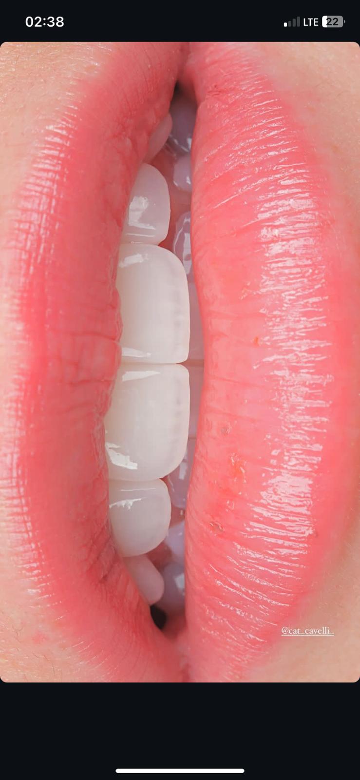 Model Teeth