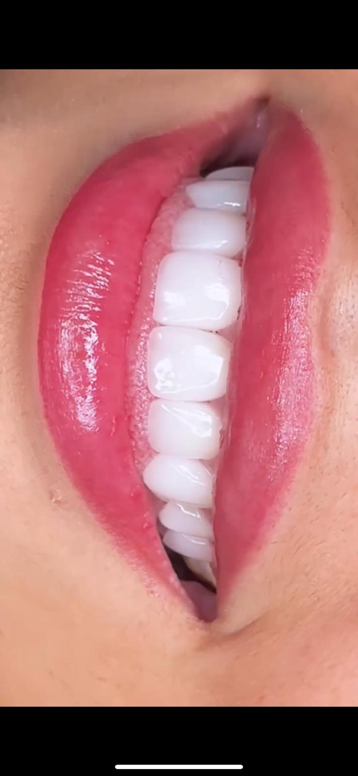Model Teeth