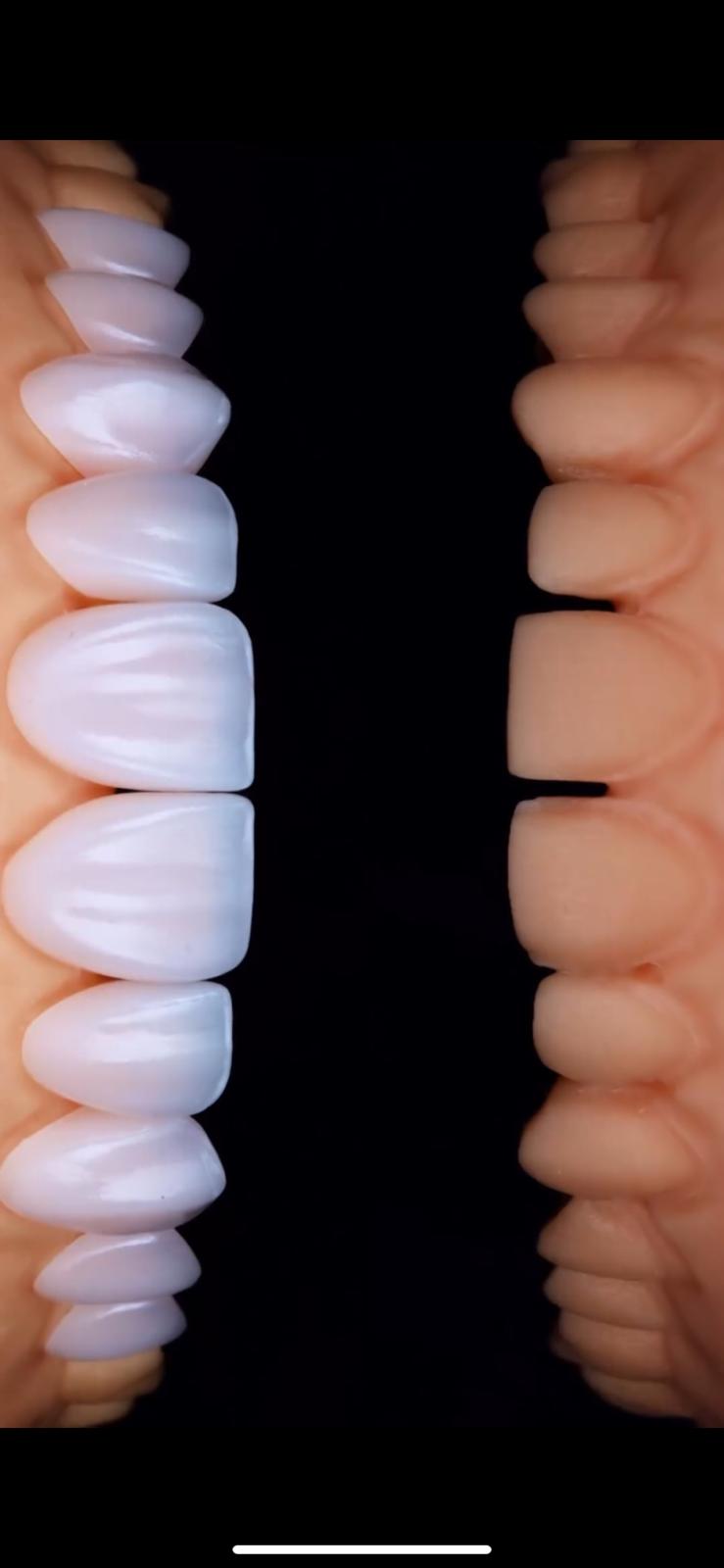 Model Teeth