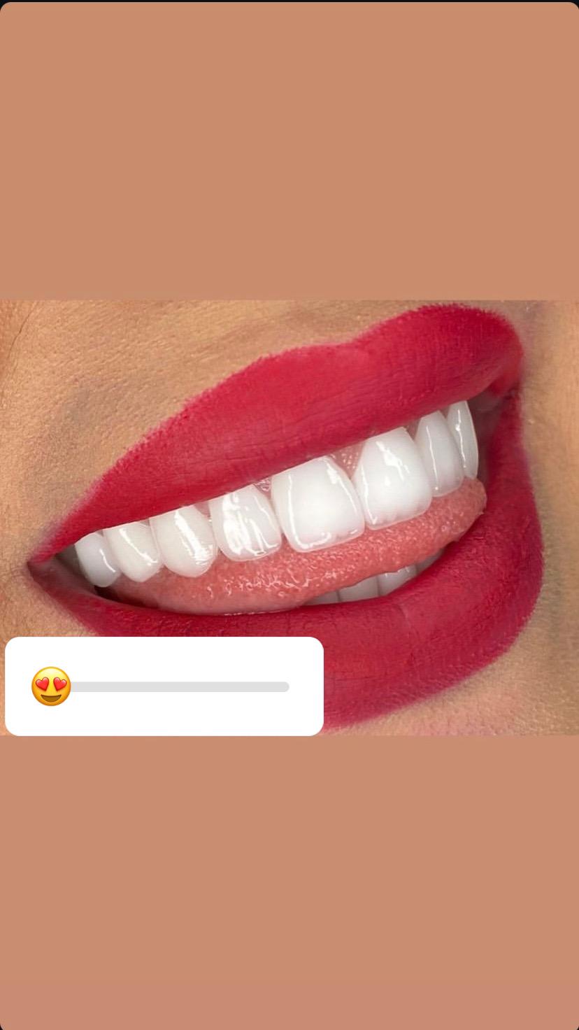 Model Teeth