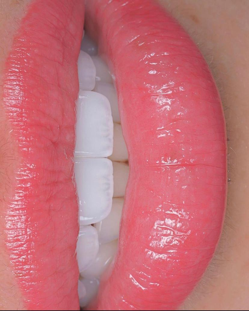 Model Teeth