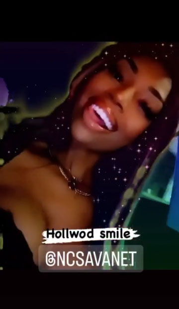 Model Teeth