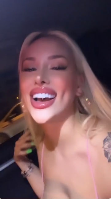 Model Teeth